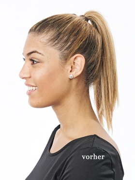 Vor dem Einsetzen des Haarteiles:  (&copy; &copy; Great Lengths)