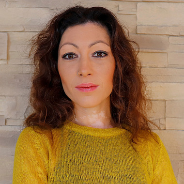 Binnaz vor der Haar-Verdichtung:  (&copy; &copy; Great Lengths)