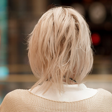 Bedingt durch kreisrunden Haarausfall hatte Gisela vorher dünnes Haar.:  (&copy; &copy; Great Lengths)