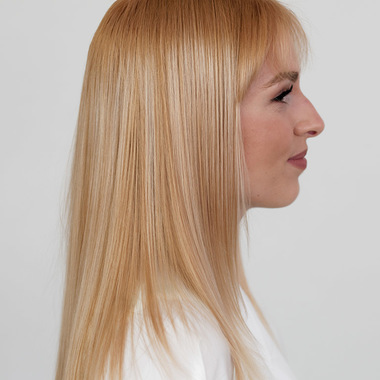 Bonding vorher (&copy; Great Lengths)