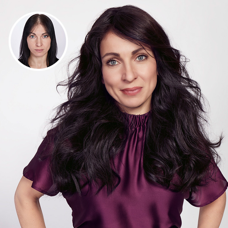 GL Volume - das innovative Oberkopfteil (&copy; Great Lengths)